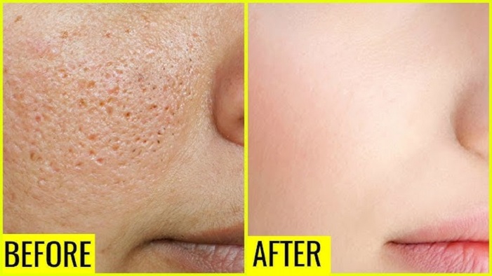 wellhealthorganic.com : remove dark spots on face tang - lemon juice 